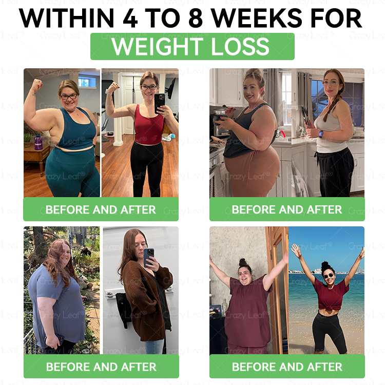 When used together with CrazyLeafยฎ GLP-1 ๐ต๐๐๐๐ ๐น๐๐๐, the effect is boosted by up to 2 times! Purchase now and enjoy a limited-time 50% special discount, helping you achieve your weight loss and health goals faster!