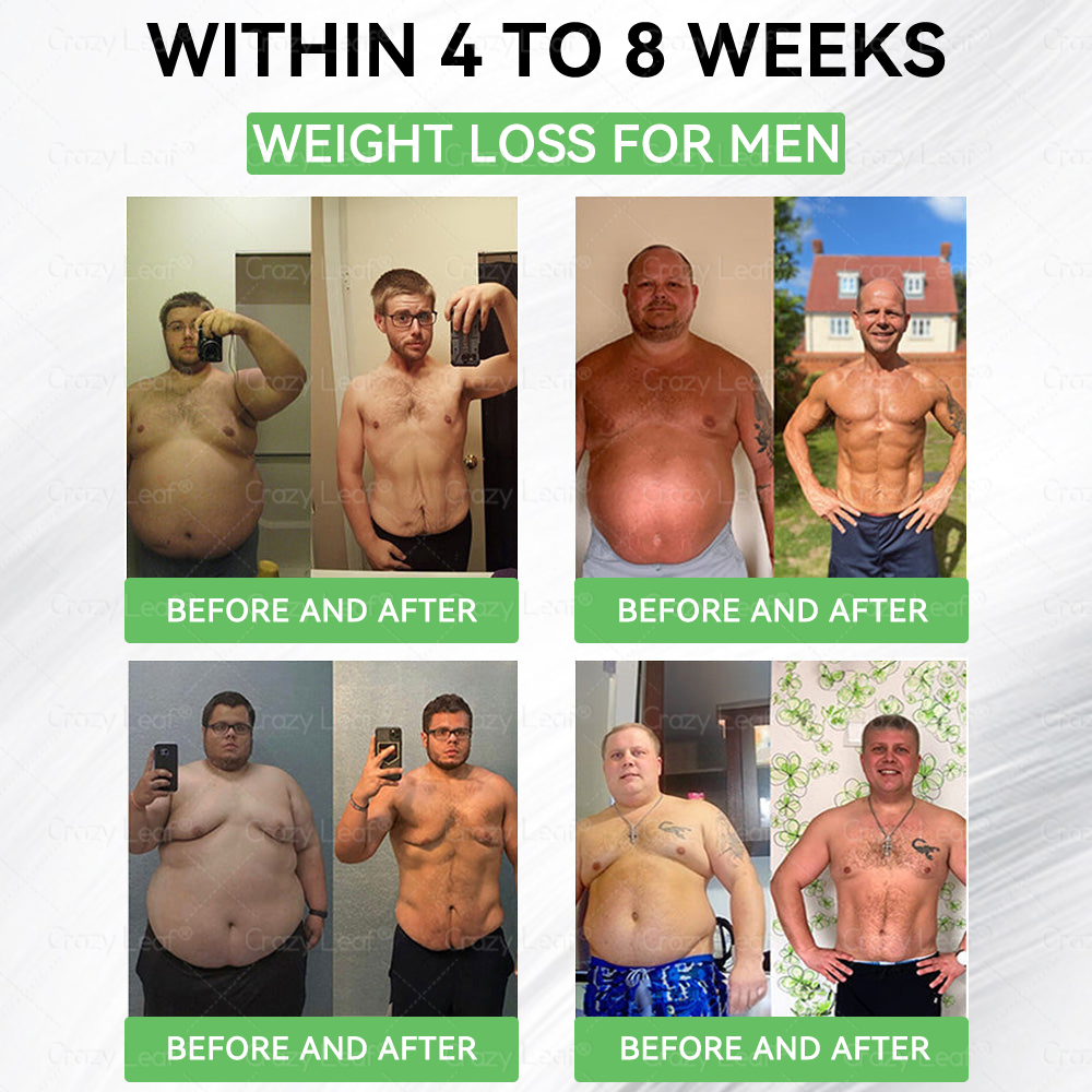 When used together with CrazyLeafยฎ GLP-1 ๐ต๐๐๐๐ ๐น๐๐๐, the effect is boosted by up to 2 times! Purchase now and enjoy a limited-time 50% special discount, helping you achieve your weight loss and health goals faster!