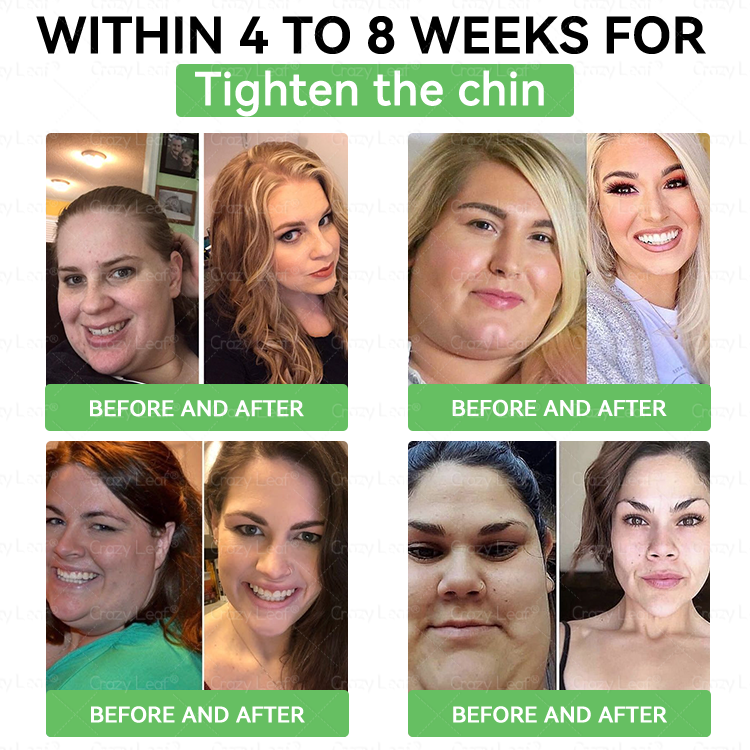 When used together with CrazyLeafยฎ GLP-1 ๐ต๐๐๐๐ ๐น๐๐๐, the effect is boosted by up to 2 times! Purchase now and enjoy a limited-time 50% special discount, helping you achieve your weight loss and health goals faster!