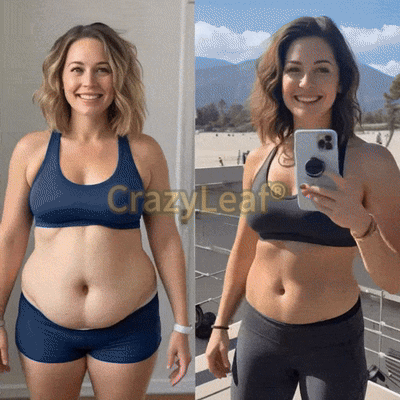 When used together with CrazyLeafยฎ GLP-1 ๐ต๐๐๐๐ ๐น๐๐๐, the effect is boosted by up to 2 times! Purchase now and enjoy a limited-time 50% special discount, helping you achieve your weight loss and health goals faster!