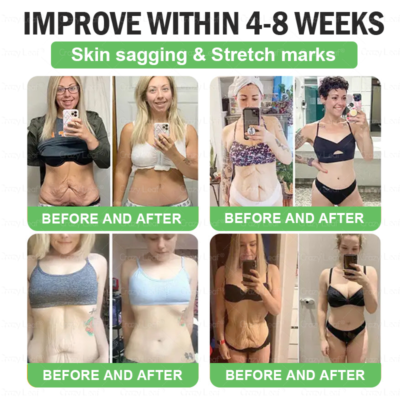 When used together with CrazyLeaf® GLP-1 𝑵𝒂𝒔𝒂𝒍 𝑹𝒊𝒏𝒈, the effect is boosted by up to 2 times! Purchase now and enjoy a limited-time 50% special discount, helping you achieve your weight loss and health goals faster!
