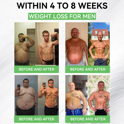 When used together with CrazyLeaf® GLP-1 𝑵𝒂𝒔𝒂𝒍 𝑹𝒊𝒏𝒈, the effect is boosted by up to 2 times! Purchase now and enjoy a limited-time 50% special discount, helping you achieve your weight loss and health goals faster!